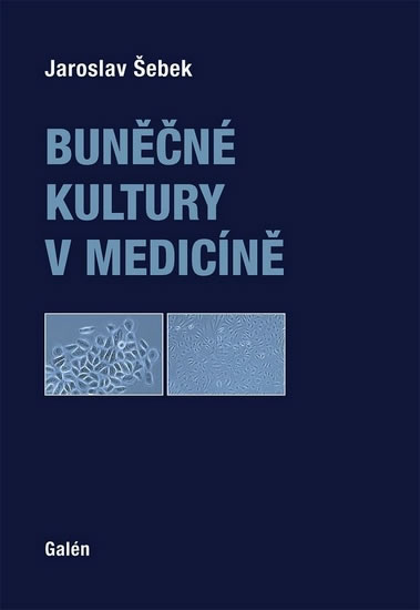 Buněčné kultury v medicíně - Šebek Jaroslav