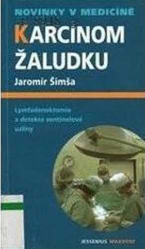 Karcinom žaludku - Lymfadenektomie a detekce sentinelové uzliny - Šimša Jaromír