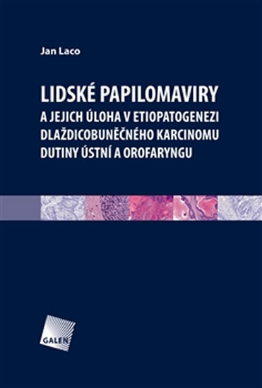 Lidské papilomaviry - Laco Jan