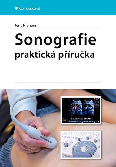 Sonografie - praktická příručka - Niehaus Jens