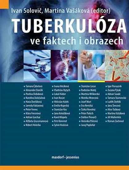 Tuberkulóza ve faktech i obrazech - Solovič Ivan