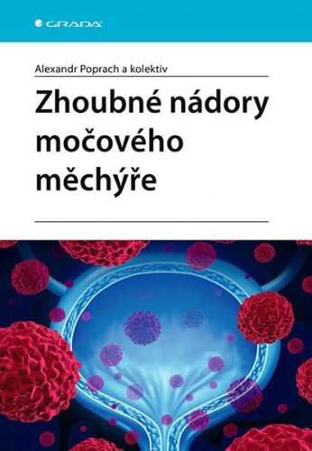 Zhoubné nádory močového měchýře - Poprach Alexandr