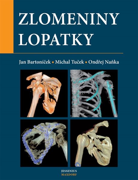 Zlomeniny lopatky - Bartoníček Jan