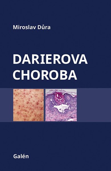 Darierova choroba - Důra Miroslav