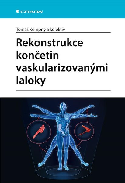 Rekonstrukce končetin vaskularizovanými laloky - Kempný Tomáš