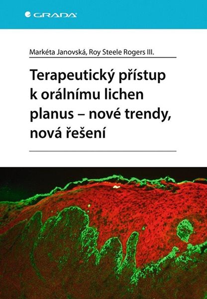 Terapeutický přístup k orálnímu lichen planus - nové trendy